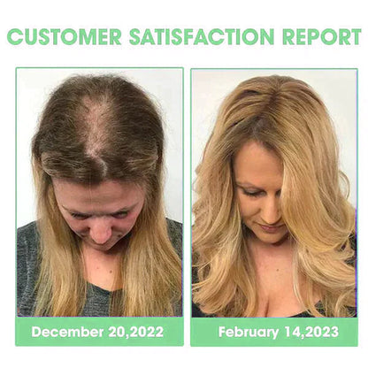 Piguiay® Hair Follicle Repair Hair Growth Solution - Latest microneedle system, rapid absorption,Achieve thicker hair quickly🌞