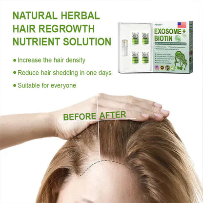 Piguiay® Hair Follicle Repair Hair Growth Solution - Latest microneedle system, rapid absorption,Achieve thicker hair quickly🌞