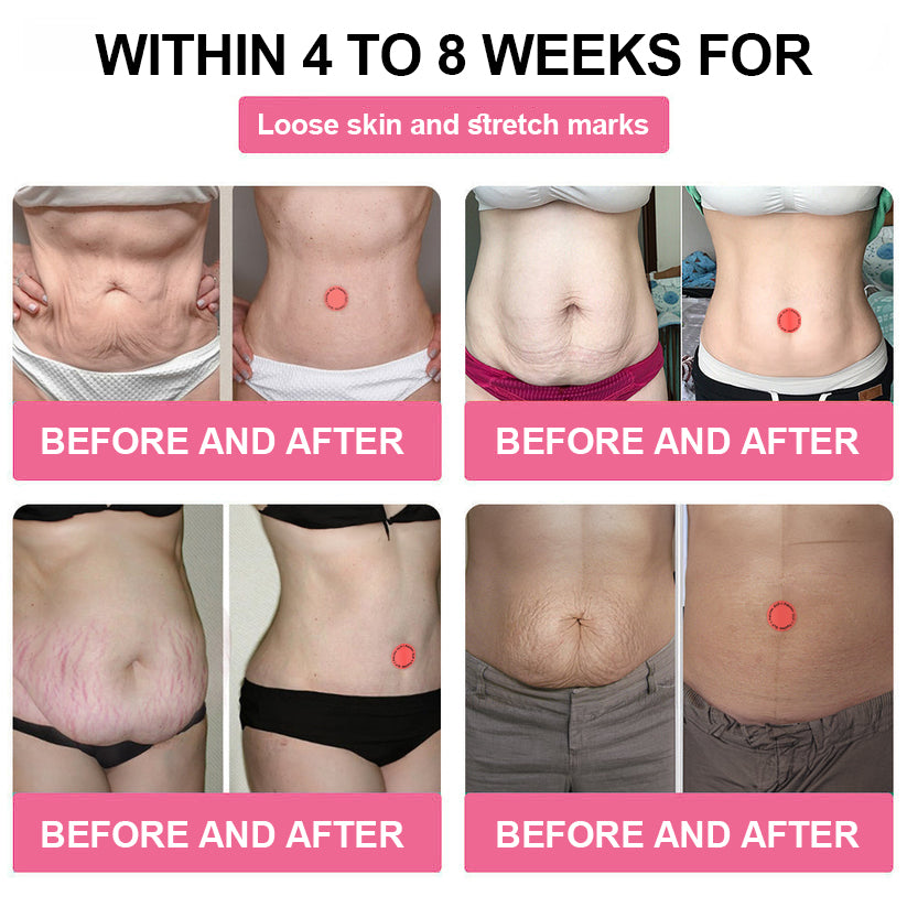 Cvreoz® Enjoy 30% OFF for adding the second one🧡