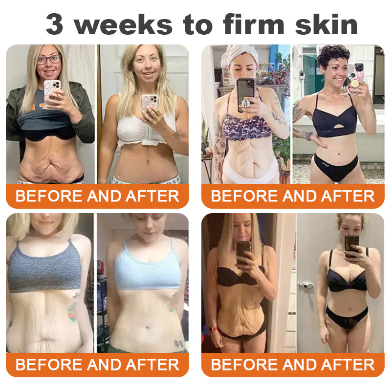 Awzlove® Luxurious Collagen & Stem Cell Anti-Cellulite Massage Oil🎉 (🔥70% Off for a Limited Time!) (Copy)🎁